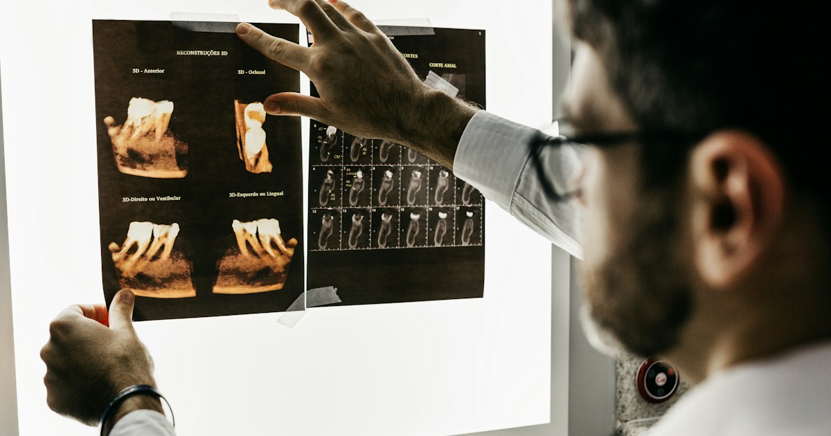 Dental Google Ads benchmarks for 2026: real CPCs by service